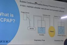 الصحة الاتحادية و'سابا' تطلقان مشروعاً لتوفير 32 جهاز CPAP للأطفال في 5 ولايات 13 IMG 20251203 WA0058
